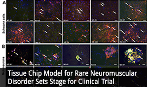 Tissue Chip Model for Rare Neuromuscular Disorder Sets Stage for Clinical Trial